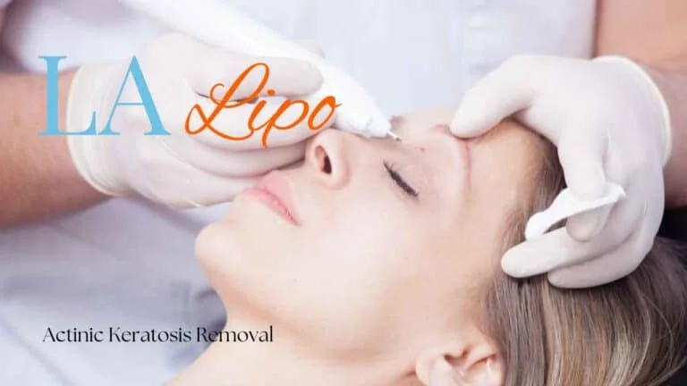 Woman receiving Actinic Keratosis Removal Treatment Lower Sydenham