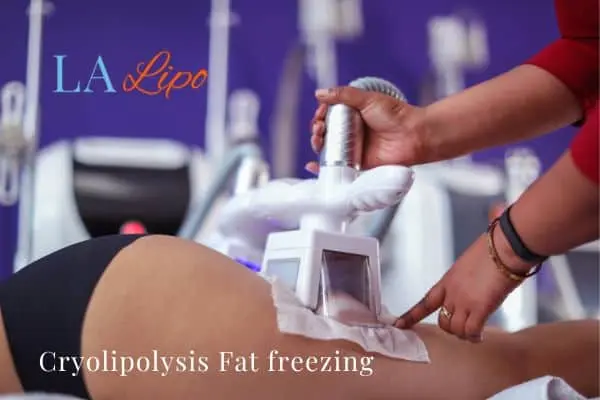 women getting fat freezing Lower Sydenham