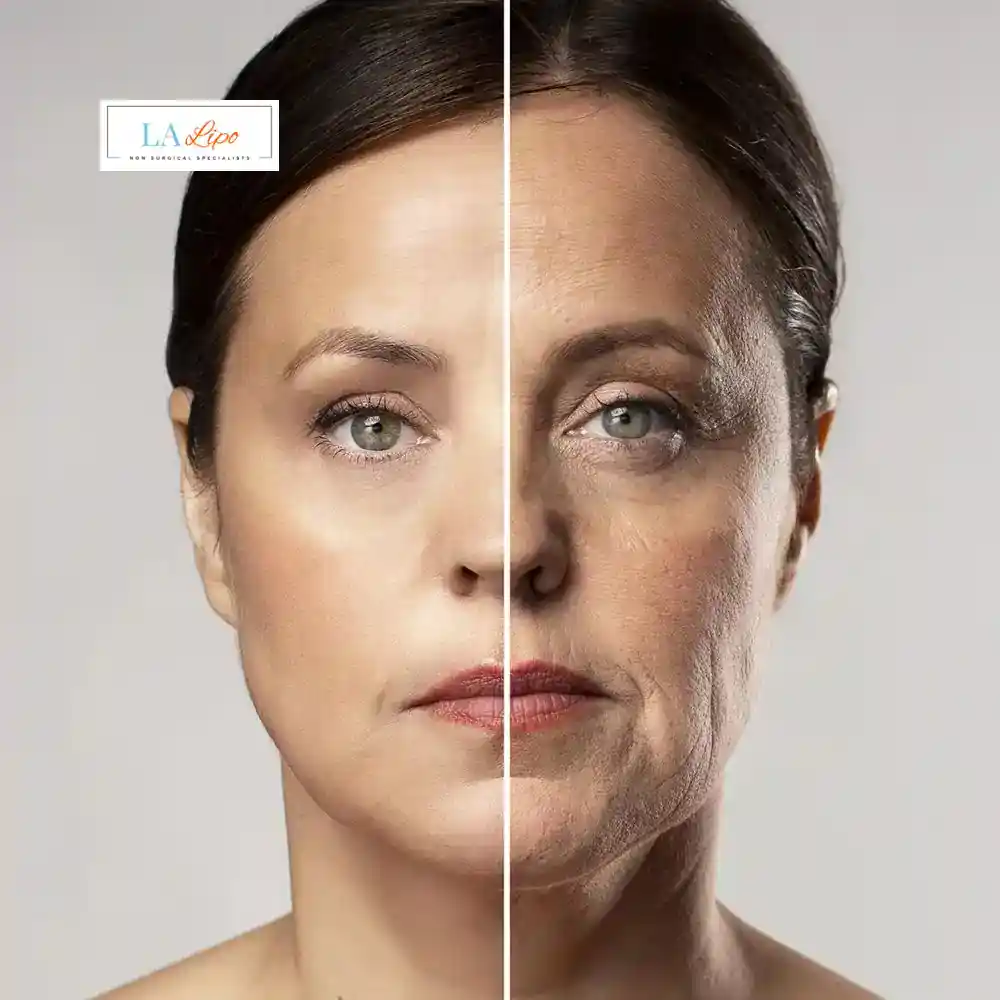 How Can You Tell If Non-Surgical Skin Tightening Is Right for You Lower Sydenham?
