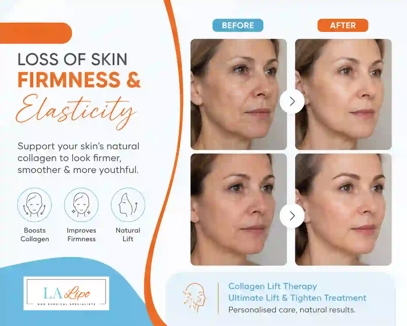 Sign #7: Loss of Skin Firmness and Elasticity Lower Sydenham